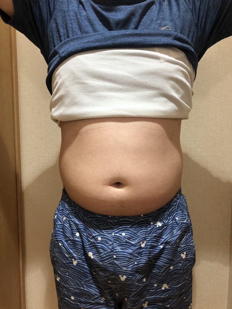 入会直後のお腹の写真